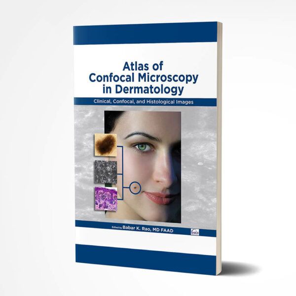 Digital - Atlas of Confocal Microscopy in Dermatology – Babar K. Rao, MD FAAD